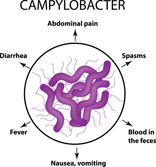 campylobacter symptoms diagram