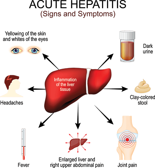 Hepatitis signs and symptoms diagram